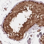 Immunohistochemical staining of human testis shows high expression.