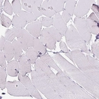 Immunohistochemical staining of human skeletal muscle shows no positivity in myocytes as expected.