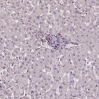 Immunohistochemical staining of human liver shows low expression as expected.