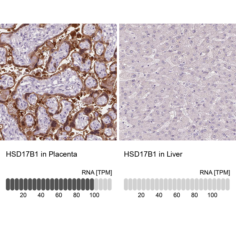 Anti-HSD17B1 Antibody