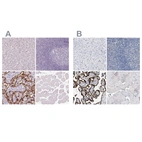 Immunohistochemical staining of human liver, lymphoid tissues, placenta and skeletal muscle using Anti-HSD17B1 antibody HPA065296 (A) shows similar protein distribution across tissues to independent antibody HPA021032 (B).