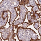 Anti-HSD17B1 Antibody