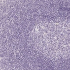 Immunohistochemical staining of human tonsil shows no cytoplasmic positivity in non-germinal center cells as expected.