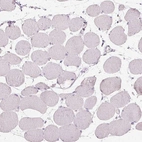 Immunohistochemical staining of human skeletal muscle shows no cytoplasmic positivity in myocytes as expected.