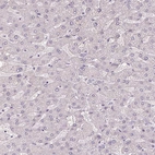 Immunohistochemical staining of human liver shows no cytoplasmic positivity in hepatocytes as expected.