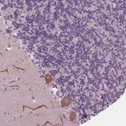 Anti-SAMD4A Antibody