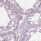 Immunohistochemical staining of human testis shows moderate cytoplasmic positivity in Leydig cells.