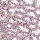 Anti-SAMD4A Antibody