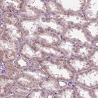 Immunohistochemical staining of human kidney shows moderate cytoplasmic positivity in cells in tubules.