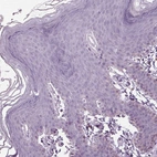Immunohistochemical staining of human skin shows no positivity in squamous epithelial cells.