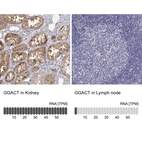 Anti-GGACT Antibody