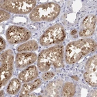Immunohistochemical staining of human kidney shows high expression.