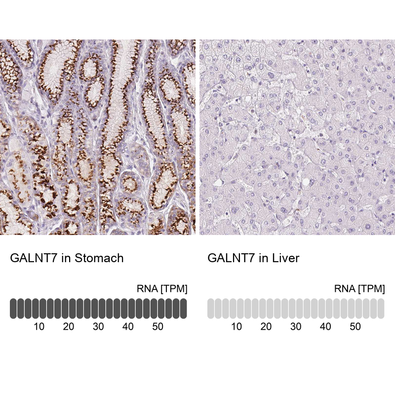 Anti-GALNT7 Antibody