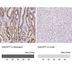 Anti-GALNT7 Antibody