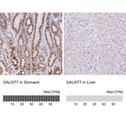 Anti-GALNT7 Antibody