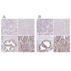 Immunohistochemical staining of human kidney, liver, prostate and stomach using Anti-GALNT7 antibody HPA065317 (A) shows similar protein distribution across tissues to independent antibody HPA064243 (B).