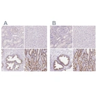 Immunohistochemical staining of human kidney, liver, prostate and stomach using Anti-GALNT7 antibody HPA065317 (A) shows similar protein distribution across tissues to independent antibody HPA064243 (B).