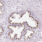 Immunohistochemical staining of human prostate shows strong positivity in glandular cells of Golgi apparatus.