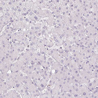 Immunohistochemical staining of human liver shows no positivity in hepatocytes as expected.