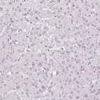 Immunohistochemical staining of human liver shows no positivity in hepatocytes as expected.
