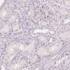 Immunohistochemical staining of human kidney shows no positivity in cells in tubules as expected.