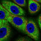 Immunofluorescent staining of human cell line MCF7 shows localization to cytosol & endoplasmic reticulum.