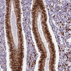 Immunohistochemical staining of human endometrium shows strong nuclear positivity in glandular cells.