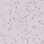 Anti-SMIM12 Antibody