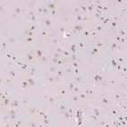 Anti-SMIM12 Antibody
