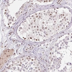 Immunohistochemical staining of human testis shows weak to moderate nuclear positivity in a subset cells in seminiferous ducts.