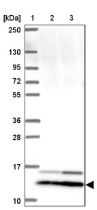 Lane 1: Marker [kDa] 250, 130, 95, 72, 55, 36, 28, 17, 10_br/_Lane 2: Human cell line RT-4_br/_Lane 3: Human cell line U-251 MG