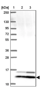Lane 1: Marker [kDa] 250, 130, 95, 72, 55, 36, 28, 17, 10_br/_Lane 2: Human cell line RT-4_br/_Lane 3: Human cell line U-251 MG
