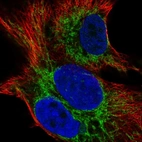 Immunofluorescent staining of human cell line SK-MEL-30 shows localization to mitochondria.