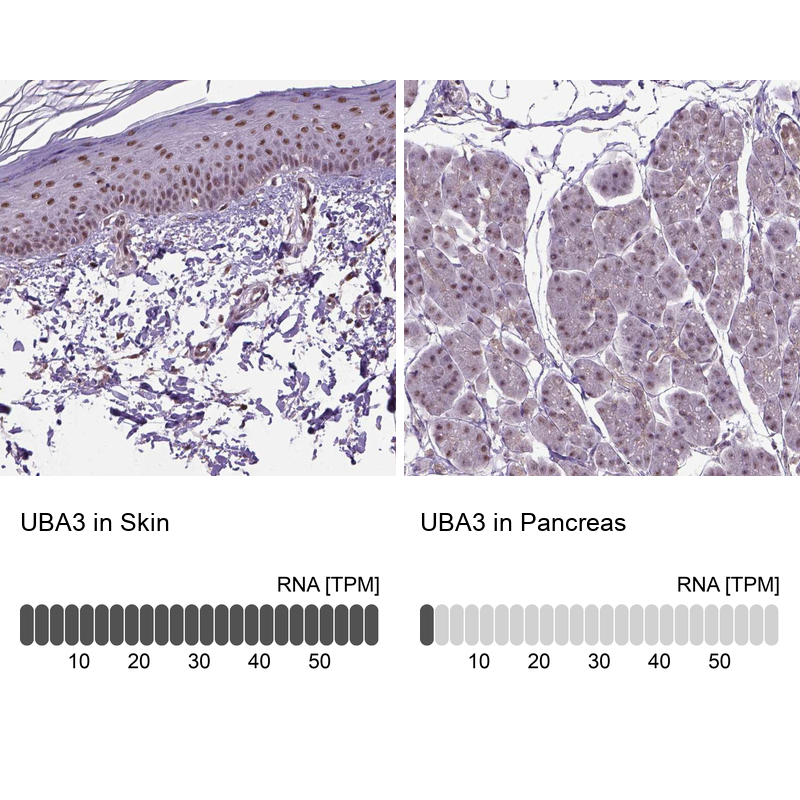 Anti-UBA3 Antibody