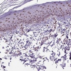 Immunohistochemical staining of human skin shows high expression.