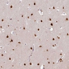 Immunohistochemical staining of human cerebral cortex shows strong nuclear positivity in neurons.