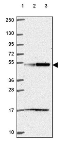 Lane 1: Marker [kDa] 250, 130, 95, 72, 55, 36, 28, 17, 10_br/_Lane 2: Human cell line RT-4_br/_Lane 3: Human cell line U-251 MG