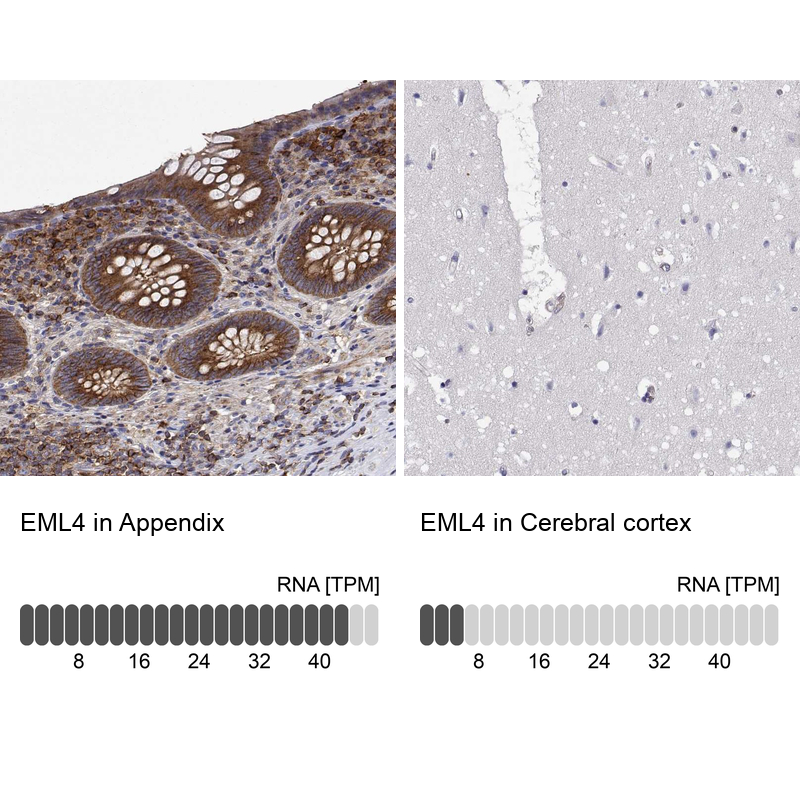 Anti-EML4 Antibody