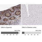 Anti-EML4 Antibody
