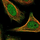 Immunofluorescent staining of human cell line SiHa shows localization to nucleoplasm, plasma membrane & centrosome.