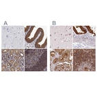 Immunohistochemical staining of human cerebral cortex, gallbladder, kidney and lymph node using Anti-EML4 antibody HPA065337 (A) shows similar protein distribution across tissues to independent antibody HPA036687 (B).