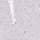 Immunohistochemical staining of human cerebral cortex shows low expression as expected.