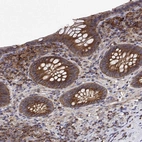 Immunohistochemical staining of human appendix shows high expression.