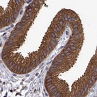 Immunohistochemical staining of human gallbladder using Anti-EML4 antibody HPA065337.