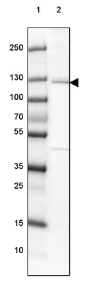 Lane 1: Marker [kDa] 250, 130, 100, 70, 55, 35, 25, 15, 10_br/_Lane 2: Human cell line HepG2