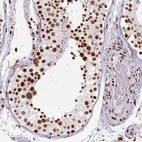 Immunohistochemical staining of human testis shows strong nuclear positivity in cells in seminiferous ducts.