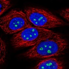 Immunofluorescent staining of human cell line HaCaT shows localization to nucleus & nucleoli.