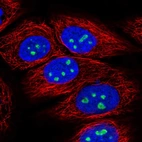 Immunofluorescent staining of human cell line HaCaT shows localization to nucleus & nucleoli.
