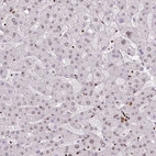 Immunohistochemical staining of human liver shows only very weak nuclear positivity in hepatocytes.