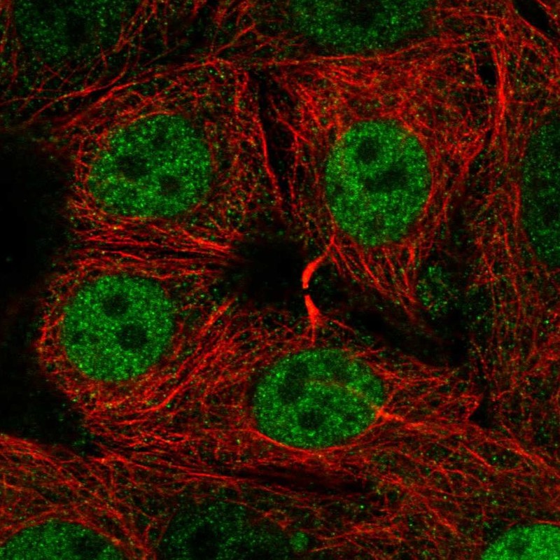 Anti-SIVA1 Antibody
